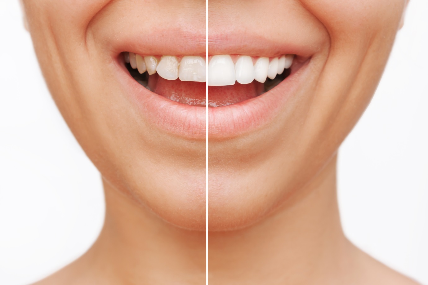 Cropped shot of a young caucasian smiling woman before and after