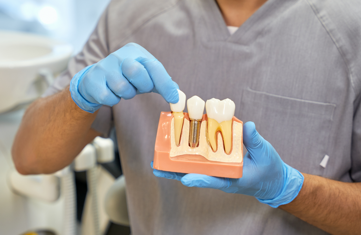 dental_implants_Port_Moody_dentist